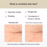 Wrinkle Improvement Shiseido Wrinkle cream Elixir Retinol Smoothing Cream 15g